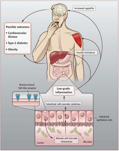 Fermented Foods for Gut Health | The Paleo Diet